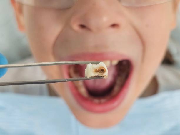 Best Weekend Emergency Dentist in Lynchburg, OH