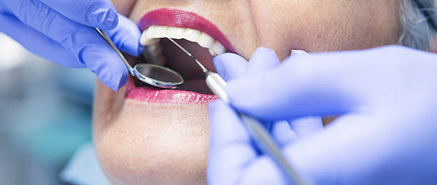 Best Emergency Root Canal Treatment in Lynchburg, OH